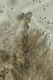 Bulgariella pulla image