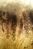 Bulgariella pulla image