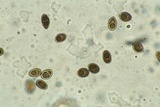 Bulgariella pulla image
