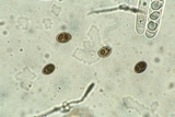 Bulgariella pulla image