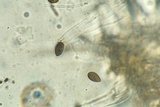 Bulgariella pulla image