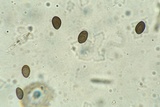 Bulgariella pulla image