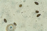 Bulgariella pulla image
