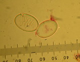 Peziza vesiculosa image