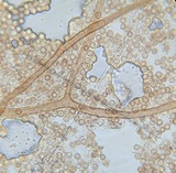 Lycoperdon mammiforme image