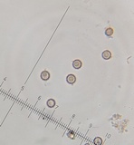 Lycoperdon mammiforme image