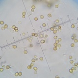 Lycoperdon asperum image