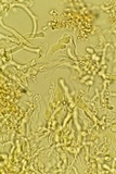 Corticium lombardiae image