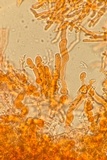 Corticium lombardiae image