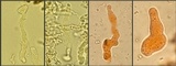 Corticium lombardiae image
