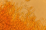 Corticium lombardiae image