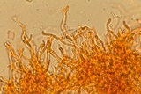 Corticium lombardiae image