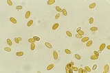 Serpula himantioides image