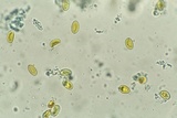 Serpula himantioides image