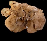 Osteina obducta image
