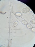 Scutellinia umbrorum image