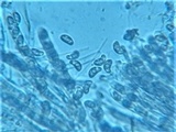 Rutstroemia sydowiana image