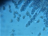 Rutstroemia sydowiana image