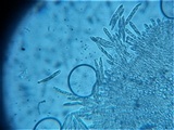 Incrucipulum ciliare image