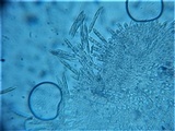 Incrucipulum ciliare image