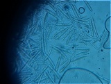 Incrucipulum ciliare image