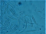 Incrucipulum ciliare image