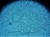 Incrucipulum ciliare image
