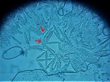 Incrucipulum ciliare image