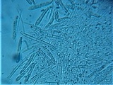 Incrucipulum ciliare image