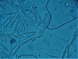 Incrucipulum ciliare image