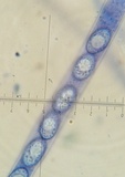 Scutellinia umbrorum image