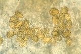 Gautieria morchelliformis image
