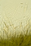 Eutypa spinosa image
