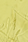 Eutypa spinosa image