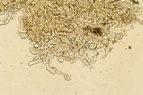 Arthrophaga myriapodina image