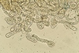 Arthrophaga myriapodina image