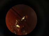 Hesperomyces virescens image