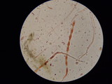 Sarcoscypha austriaca image