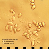 Clitocybe gibba image
