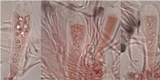 Lecidella stigmatea image