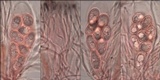 Lecidella stigmatea image