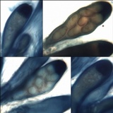 Lecidella stigmatea image