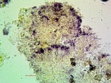 Micarea misella image
