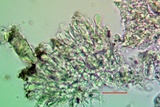 Micarea misella image