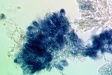Micarea misella image