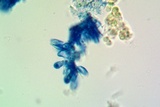 Micarea misella image