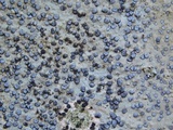 Porpidia albocaerulescens var. albocaerulescens image