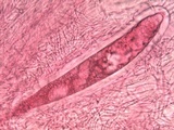 Pertusaria hymenea image