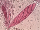 Pertusaria hymenea image