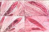 Pertusaria hymenea image